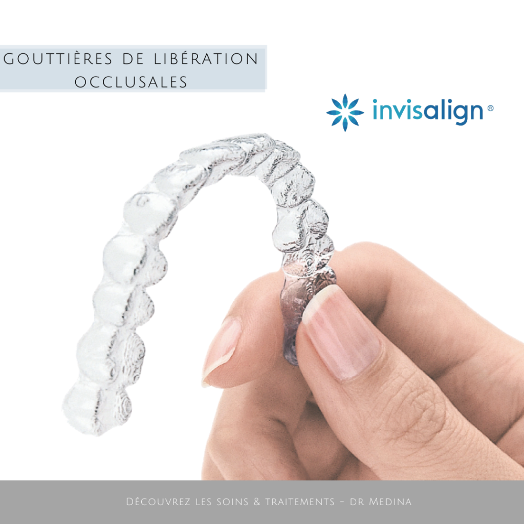 Main tenant une gouttiere occlusale transparente