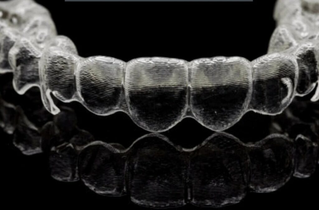 Gouttières occlusales transparentes posées sur une arcade dentaire
