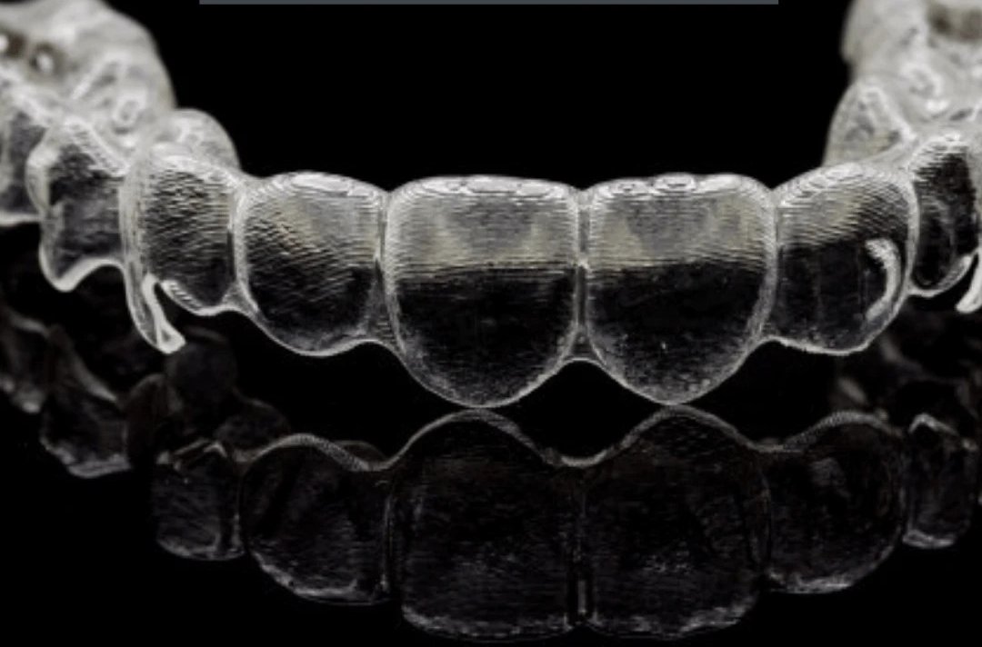 Gouttières occlusales transparentes posées sur une arcade dentaire